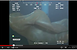 Deepstaria enigmatica. Screenshot: Cascade Creature youtube Deepstaria enigmatica. Screenshot: Cascade Creature youtube