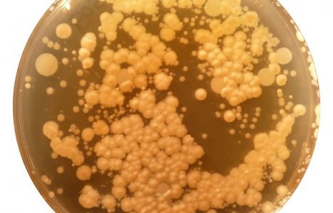 Staphylococcus Foto: Neil McCoy